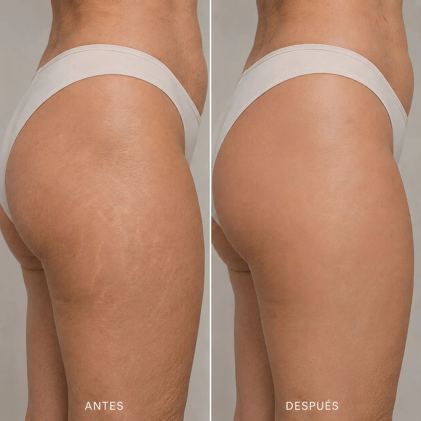 Crema Coreana Celimax para Estrías Visibles