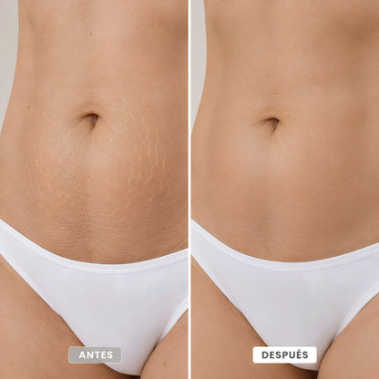 Crema Coreana Celimax para Estrías Visibles