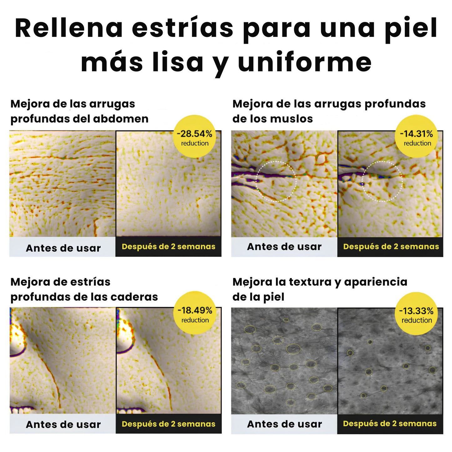 Crema Coreana Celimax para Estrías Visibles