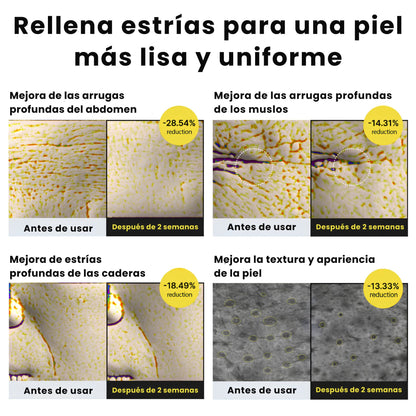 Crema Coreana Celimax para Estrías Visibles