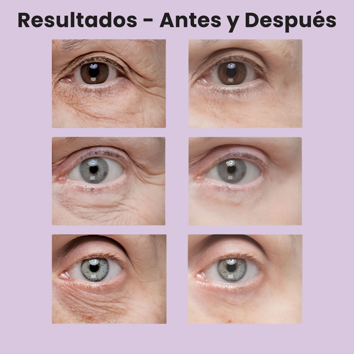 Reafirmante de Ojos con Efecto Lifting Instantáneo - SeoulGlow®