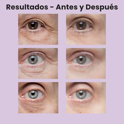 Reafirmante de Ojos con Efecto Lifting Instantáneo - SeoulGlow®