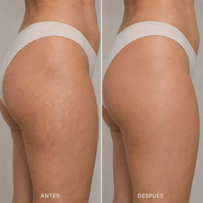 Crema Coreana Celimax para Estrías Visibles