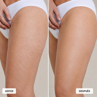 Crema Coreana Celimax para Estrías Visibles