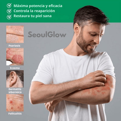 SeoulGlow® Tratamiento Anti Picores y Hidratante PRO – Fórmula 100% Natural - SeoulGlow