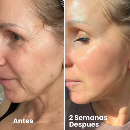 Crema Coreana con Retinal para Arrugas y Firmeza NIDA Anti-Age