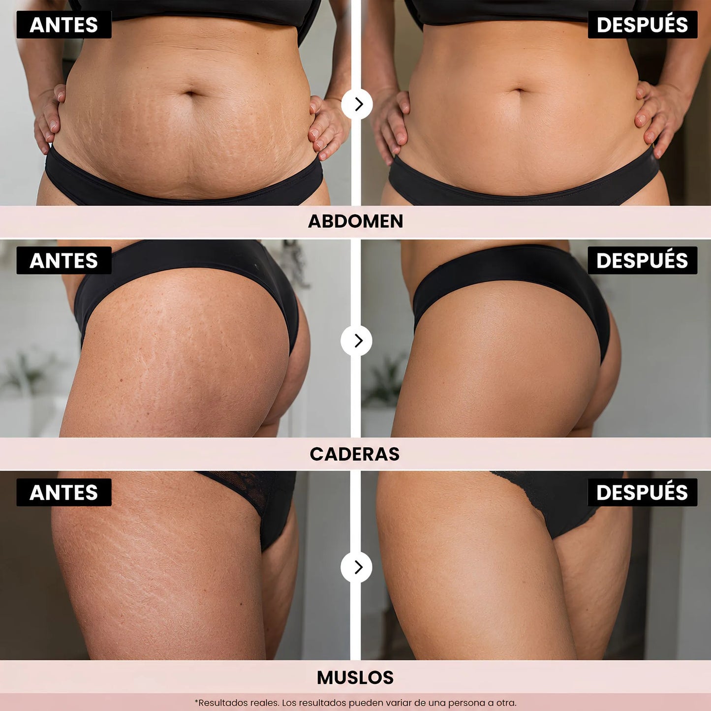 Crema Coreana Celimax para Estrías Visibles